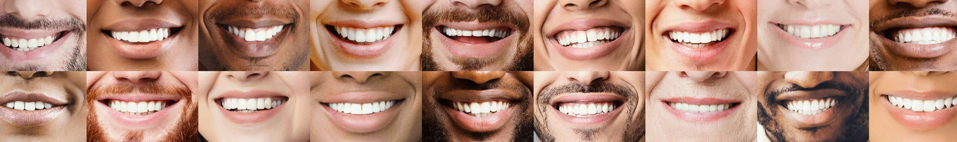 FAQ - Doncaster Dental Centre | miles more smiles
